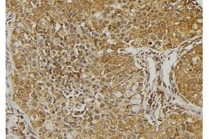 ABIN6273221 at 1/100 staining Human pancreas tissue by IHC-P. (CXCL14 anticorps  (Internal Region))