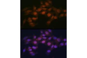 Immunofluorescence analysis of NIH-3T3 cells using WAPL Rabbit mAb (ABIN7271380) at dilution of 1:100 (40x lens). (WAPAL anticorps)