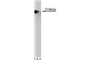 Western Blotting (WB) image for anti-Nuclear Protein, Ataxia-Telangiectasia Locus (NPAT) (AA 681-803) antibody (ABIN968484)