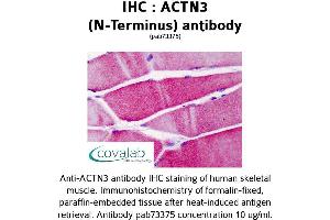 Image no. 1 for anti-Actinin, alpha 3 (ACTN3) antibody (ABIN1731492)