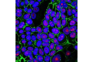 MCF-7 cells stained with CF555 Cyclin B1 Mouse Monoclonal Antibody (CCNB1/1098) (nuclei/nucleoli, red) and CF488A phalloidin (actin filaments, green).