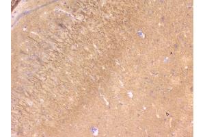 IHC analysis of PBP using anti-PBP antibody (ABIN5693043).