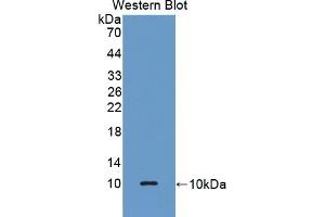 Detection of Recombinant GPX3, Human using Polyclonal Antibody to Glutathione Peroxidase 3, Plasma (GPX3)