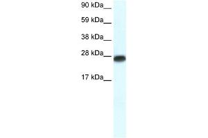 WB Suggested Anti-MYF6 Antibody Titration:  0. (MYF6 anticorps  (N-Term))