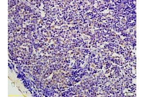 Formalin-fixed and paraffin embedded mouse colon carcinoma labeled with Anti-AMPK beta 1 Polyclonal Antibody, Unconjugated  at 1:200 followed by conjugation to the secondary antibody and DAB staining.