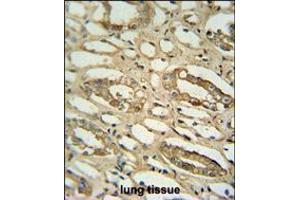 GGTLC2 antibody immunohistochemistry analysis in formalin fixed and paraffin embedded human lung tissue followed by peroxidase conjugation of the secondary antibody and DAB staining. (GGTLC2 anticorps  (AA 127-154))