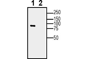Western blot analysis of human  MG glioblastoma cell line lysate (lane 1) and  MG-derived purified exosomes (lane 2)50μg of cells and purified exosomes lysates were analyzed using Anti-Calnexin Antibody (ABIN7043021, ABIN7044212 and ABIN7044213), (1:600). (Calnexin (CANX) Peptide)