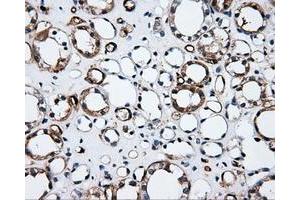 Immunohistochemical staining of paraffin-embedded Kidney tissue using anti-CD36mouse monoclonal antibody. (CD36 anticorps)