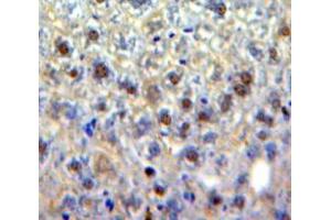 Used in DAB staining on fromalin fixed paraffin-embedded Liver tissue