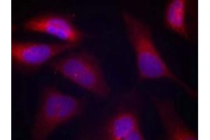 Immunofluorescence staining of methanol-fixed Hela cells using PKR(Phospho-Thr446) Antibody. (EIF2AK2 anticorps  (pThr446))