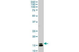 ID1 monoclonal antibody (M02), clone 1F7 Western Blot analysis of ID1 expression in Y-79