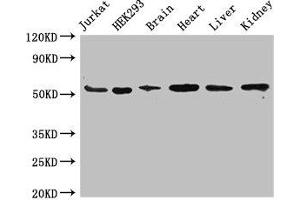 Western Blot Positive WB detected in: Jurkat whole cell lysate, HEK293 whole cell lysate, Mouse brain tissue, Mouse heart tissue, Mouse liver tissue, Mouse kidney tissue All lanes: SLC18A2 antibody at 3. (SLC18A2 anticorps  (AA 463-514))
