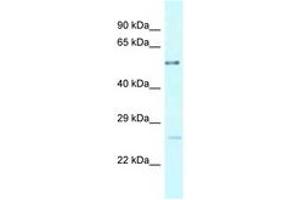 Image no. 1 for anti-Ectonucleoside Triphosphate diphosphohydrolase 3 (ENTPD3) (AA 275-324) antibody (ABIN6747780) (ENTPD3 anticorps  (AA 275-324))