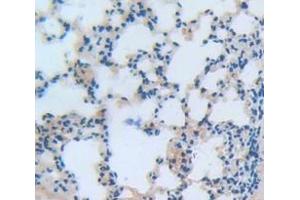 IHC-P analysis of Mouse Tissue, with DAB staining. (NCF2 anticorps  (AA 354-525))