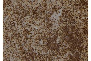 ABIN6275491 at 1/100 staining Rat spleen tissue by IHC-P. (ARHGAP18 anticorps  (Internal Region))