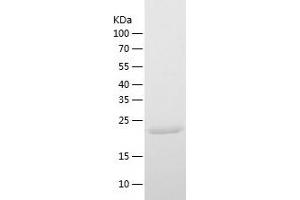 Western Blotting (WB) image for Fumarylacetoacetate Hydrolase Domain Containing 1 (FAHD1) (AA 1-224) protein (His-IF2DI Tag) (ABIN7123018)