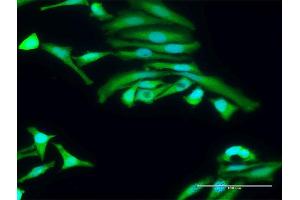 Immunofluorescence of purified MaxPab antibody to PRKAA2 on HeLa cell.