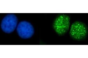 IF analysis of ATRIP using anti-ATRIP antibody (ABIN7599701). (ATRIP anticorps  (AA 109-782))