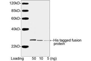 Image no. 3 for anti-His Tag (C-Term) antibody (ABIN294958)