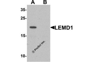 Western Blotting (WB) image for anti-LEM Domain Containing 1 (LEMD1) (Middle Region) antibody (ABIN1030979) (LEMD1 anticorps  (Middle Region))