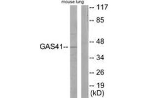 Western Blotting (WB) image for anti-YEATS Domain Containing 4 (AA 1-50) antibody (ABIN2889365) (GAS41 anticorps  (AA 1-50))