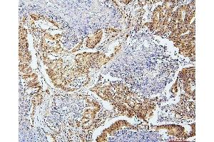 IHC analysis of SAE2/UBA2 using anti-SAE2/UBA2 antibody (ABIN7601755). (UBA2 anticorps  (AA 449-564))