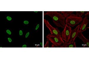 ICC/IF Image CSB antibody [N2C1], Internal detects CSB protein at nucleus by immunofluorescent analysis.