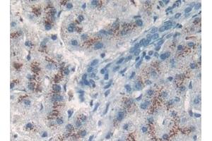 anti-TP53 Target 5 (TP53TG5) (AA 190-262) antibody