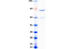 DNMT3B Protein (Transcript Variant 1) (Myc-DYKDDDDK Tag)