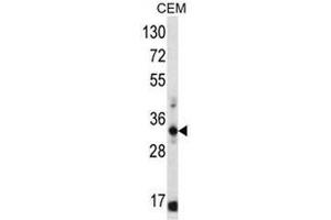 FFAR1 Antibody (C-term) western blot analysis in CEM cell line lysates (35µg/lane). (FFAR1 anticorps  (C-Term))