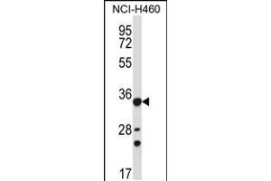 Western blot analysis in NCI-H460 cell line lysates (35ug/lane). (AKR1B10 anticorps  (AA 101-130))