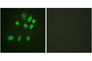 Immunofluorescence analysis of HeLa cells, using Estrogen Receptor-beta (Ab-105) Antibody. (ESR2 anticorps  (AA 71-120))