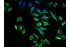 Immunofluorescence staining of A549 cells with ABIN7175266 at 1:133, counter-stained with DAPI.