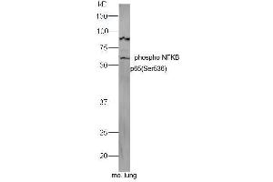 Mouse lung lysates probed with Rabbit Anti-NFkB p65 (Ser536) Polyclonal Antibody, Unconjugated  at 1:5000 for 90 min at 37˚C. (NF-kB p65 anticorps  (pSer536))
