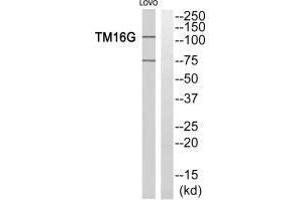 Western blot analysis of extracts from LOVO cells, using TM16G antiobdy. (Anoctamin 7 anticorps  (C-Term))