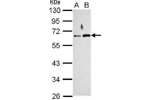 WB Image Sample (30 ug of whole cell lysate) A: Jurkat B: K562 10% SDS PAGE antibody diluted at 1:1000 (RAD9A anticorps  (Center))
