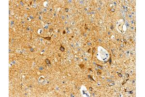 ABIN7093281 and ABIN7097300 at 1/100 staining Mouse testis tissue by IHC-P.