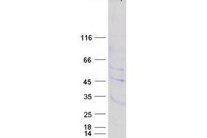 Validation with Western Blot