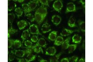 Immunostaining of HeLa cells with the anti-mitochondria antibody. (Mitochondria anticorps)