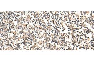 Immunohistochemistry of paraffin-embedded Human tonsil tissue using MAGEA1 Polyclonal Antibody at dilution of 1:65(x200) (MAGEA1 anticorps)