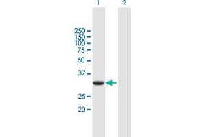 Western Blot analysis of PIM2 expression in transfected 293T cell line by PIM2 MaxPab polyclonal antibody. (PIM2 anticorps  (AA 1-311))