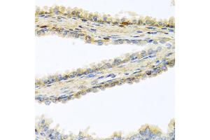 Immunohistochemistry of paraffin-embedded human prostate using GPLD1 antibody (ABIN5973975) at dilution of 1/100 (40x lens). (GPLD1 anticorps)