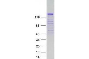 Validation with Western Blot