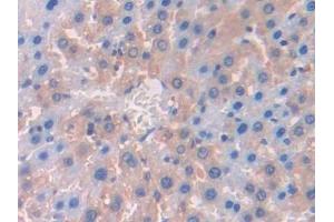 Detection of LCAT in Rat Liver Tissue using Polyclonal Antibody to Lecithin Cholesterol Acyltransferase (LCAT) (LCAT anticorps  (AA 41-210))