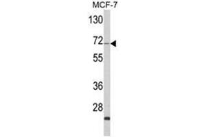 Western blot analysis of ZYG11A Antibody (N-term) in MCF-7 cell line lysates (35ug/lane).