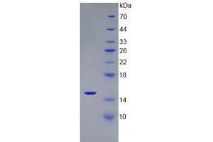 SDS-PAGE of Protein Standard from the Kit (Highly purified E. (CST3 Kit ELISA)