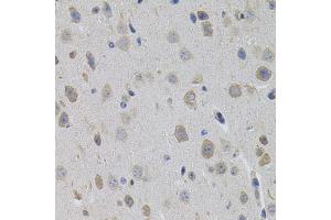 Immunohistochemistry of paraffin-embedded mouse brain using SUMO3 antibody (ABIN5971585) (40x lens). (SUMO3 anticorps)