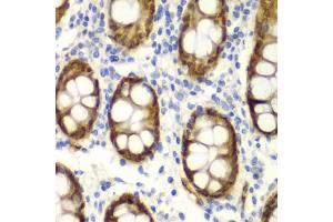 Immunohistochemistry of paraffin-embedded human colon using GIPC2 antibody (ABIN5970567) at dilution of 1/100 (40x lens). (GIPC2 anticorps)