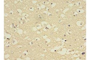 Immunohistochemistry of paraffin-embedded human brain tissue using ABIN7149247 at dilution of 1:100