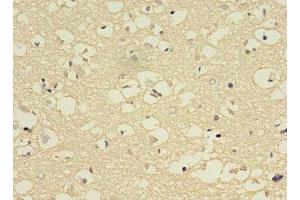 Immunohistochemistry of paraffin-embedded human brain tissue using ABIN7149247 at dilution of 1:100 (CYP2E1 anticorps  (AA 49-288))